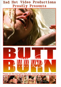 Butt Burn